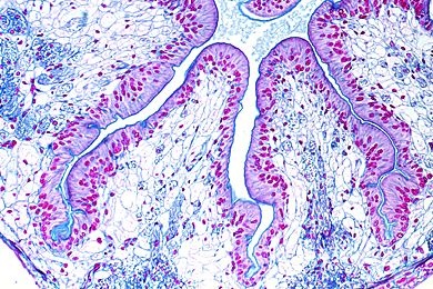 Mikropräparat - Astacus, Darm quer