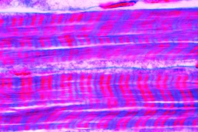 Mikropräparat - Astacus, Flußkrebs, Skelettmuskulatur, längs. Deutlich ausgeprägte Querstreifung