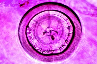 Mikropräparat - Statozyste mit Sinneshaaren und Statolithen von Praunus flexuosus. Gleichgewichtsorgan, total