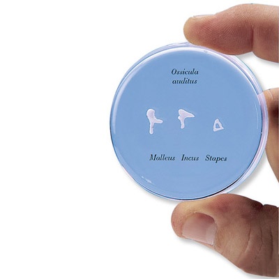 Gehörknöchelchen, natürliche Größe Gehörknöchelchen, natürliche Größe