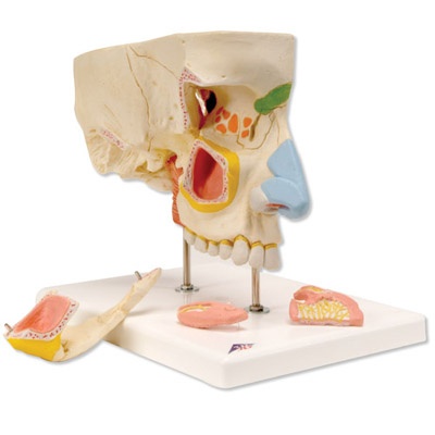 Nase mit Nasennebenhöhlen, 5-teilig Nase mit Nasennebenhöhlen, 5-teilig