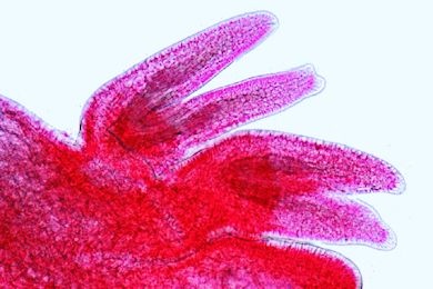 Mikropräparat - Asterias, Pedicellarien, total Mikropräparat - Asterias, Pedicellarien, total