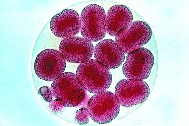 Mikropräparat - Psammechinus, Zweiunddreißig-Zellen-Stadium