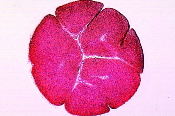 Mikropräparat - Frosch, Ei im Sechzehn-Zellen-Stadium, längs