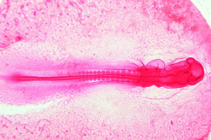 Mikropräparat - Huhn Embryo 40h, Totalpräparat. Krümmung des Vorderteils