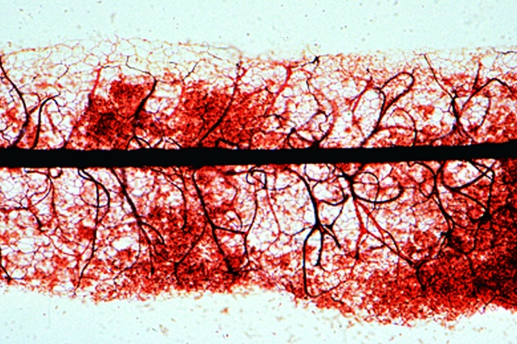 Mikropräparat - Stemonitis, Schleimpilz, Capillitium mit Sporen, total