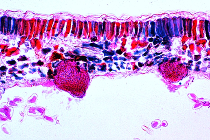 Mikropräparat - Plasmopara viticola, Falscher Mehltau des Weins, Blätter mit Konidien, quer