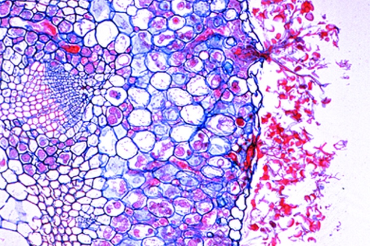 Mikropräparat - Peronospora parasitica, Falscher Mehltau der Kruziferen. Wirtsgewebe mit Konidien, quer