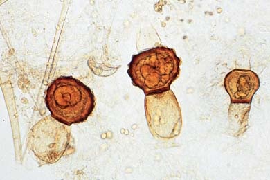 Mikropräparat - Mucor mucedo, Zygotenbildung