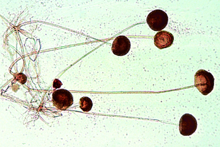 Mikropräparat - Mucor mucedo, Kopfschimmel, Myzel und Sporangien