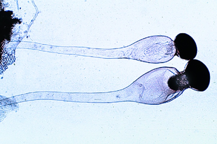 Mikropräparat - Pilobolus, Sporangienträger mit Schleudermechanismus *