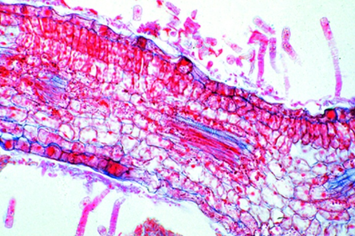 Mikropräparat - Podosphaera leucotricha, Apfelmehltau, Konidienlager quer