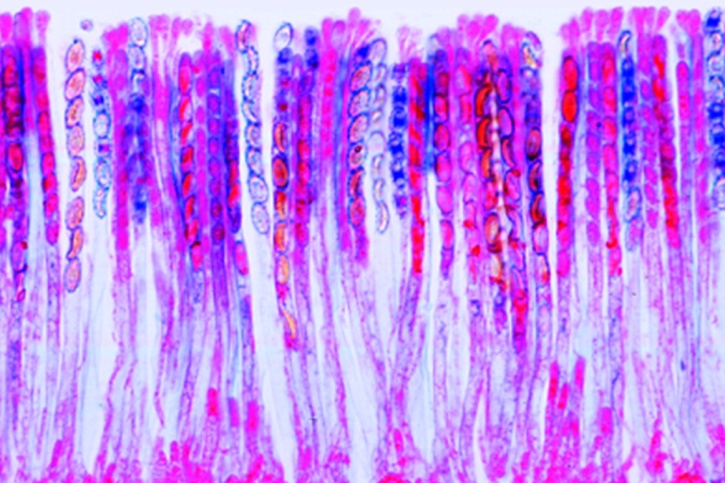 Mikropräparat - Morchella edulis, Morchel, Fruchtkörper mit Asci und Sporen, quer