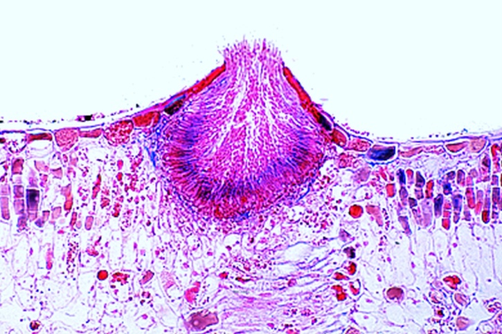 Mikropräparat - Gymnosporangium sabinae, Pyknidien am Blatt quer