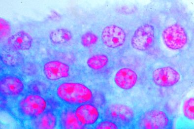 Mikropräparat - Mesothel, Schnitt durch das Mesenterium
