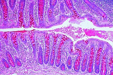 Mikropräparat - Schleimdrüsen im Darm, Mensch, Färbung der Becherzellen Mikropräparat - Schleimdrüsen im Darm, Mensch, Färbung der Becherzellen