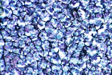 Mikropräparat - Retikuläre Fasern, Milz vom Mensch quer, Versilberung