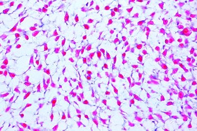 Mikropräparat - Embryonales Bindegewebe, quer