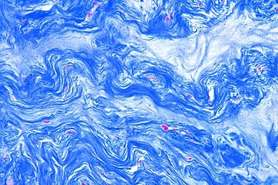 Mikropräparat - Gallertgewebe (Mesenchymgewebe), Nabelschnur des Menschen, quer
