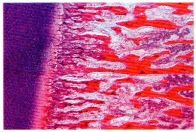 Mikropräparat - Knochen des Menschen, spongiöse Substanz quer