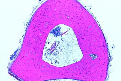 Mikropräparat - Röhrenknochen, Mensch, Dünnschliff, quer und längs