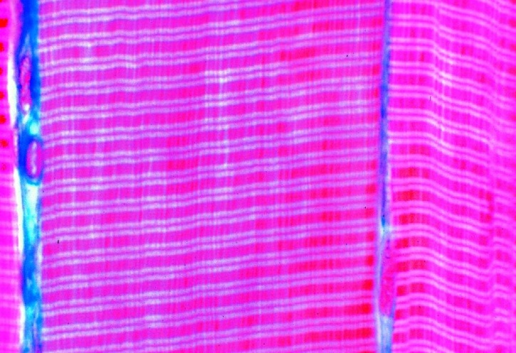 Mikropräparat Quergestreifte Muskeln Menschen längs spezielle Färbung