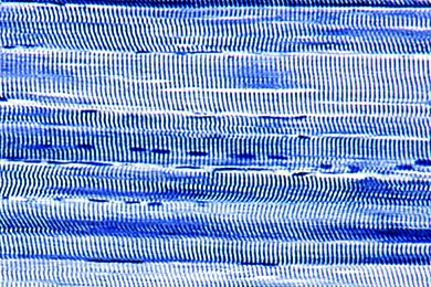 Mikropräparat - Quergestreifte Muskeln des Menschen, längs, Übersicht