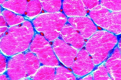 Mikropräparat - Quergestreifte Muskeln des Menschen, quer