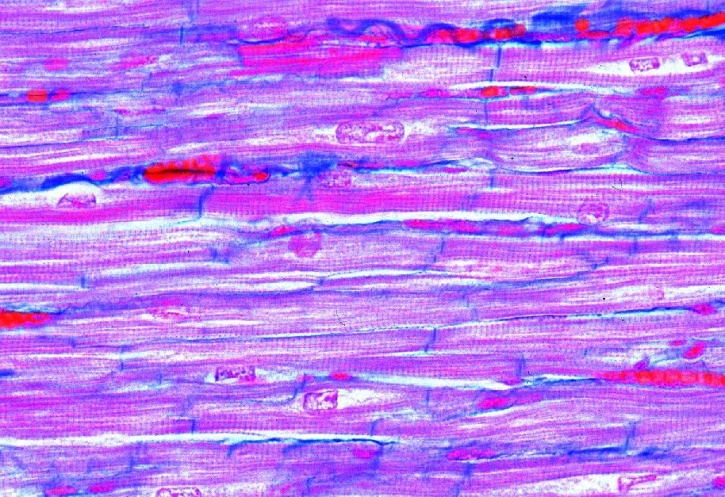 Mikropräparat - Herzmuskulatur des Menschen, längs