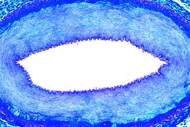 Mikropräparat - Arterie quer, Übersichtsfärbung