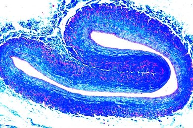 Mikropräparat - Vene quer, Übersichtsfärbung