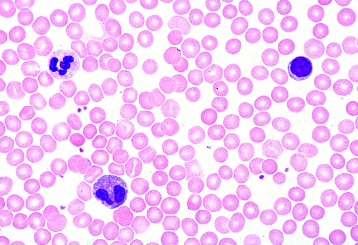 Mikropräparat - Blut vom Menschen, Ausstrich, Giemsafärbung