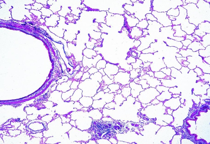 Mikropräparat - Lunge quer. Übersichtsfärbung