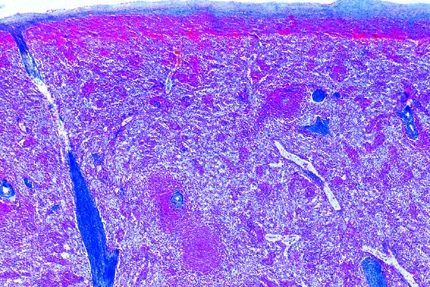 Mikropräparat - Milz quer