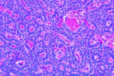 Mikropräparat - Nebenschilddrüse (Gl. parathyreoidea, quer