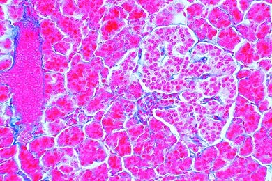 Mikropräparat - Pankreas mit Langerhansschen Inseln vom Mensch, quer