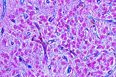 Mikropräparat - Zirbeldrüse (Epiphyse), quer