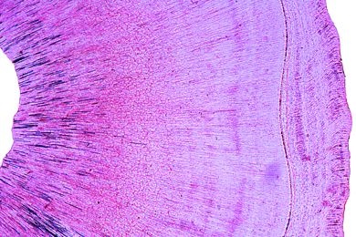 Mikropräparat - Zahn, Krone quer