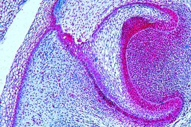 Mikropräparat - Zahnanlage vom Foetus, frühes Stadium