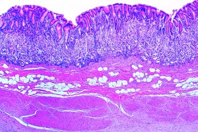 Mikropräparat - Magen, Region des Fundus, quer *