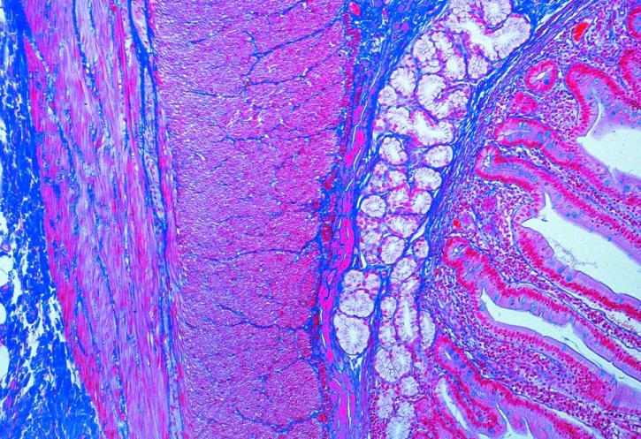 Mikropräparat - Dünndarm  (lleum), des Menschen, quer