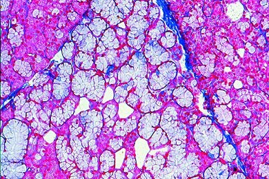 Mikropräparat - Unterzungenspeicheldrüse (Gl. sublingualis), quer