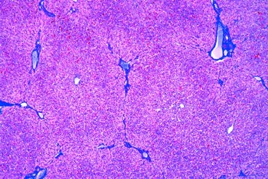 Mikropräparat - Leber des Menschen, quer