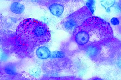 Mikropräparat - Leber des Menschen, Glykogenfärbung, Schnitt