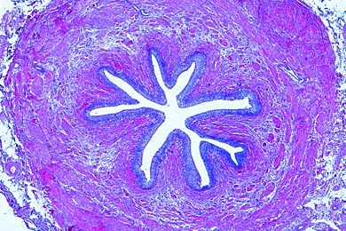 Mikropräparat - Harnleiter (Ureter), quer