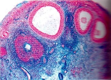 Mikropräparat - Eierstock, junge Frau (aktive Phase), quer