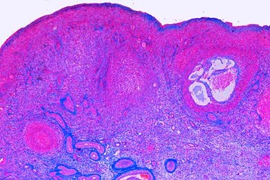Mikropräparat - Eierstock, ältere Frau (inaktive Phase, postmenopause), quer