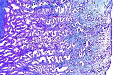 Mikropräparat - Uterus vom Mensch, quer, Übersicht