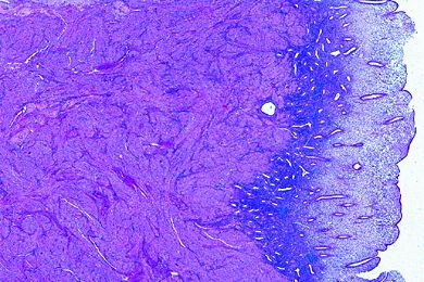 Mikropräparat - Uterus, Proliferationsphase, quer