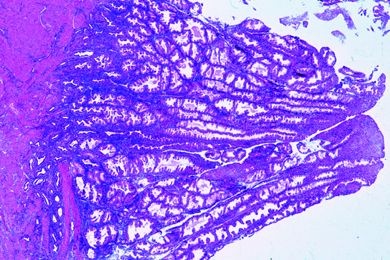 Mikropräparat - Uterus, Sekretionsphase, quer